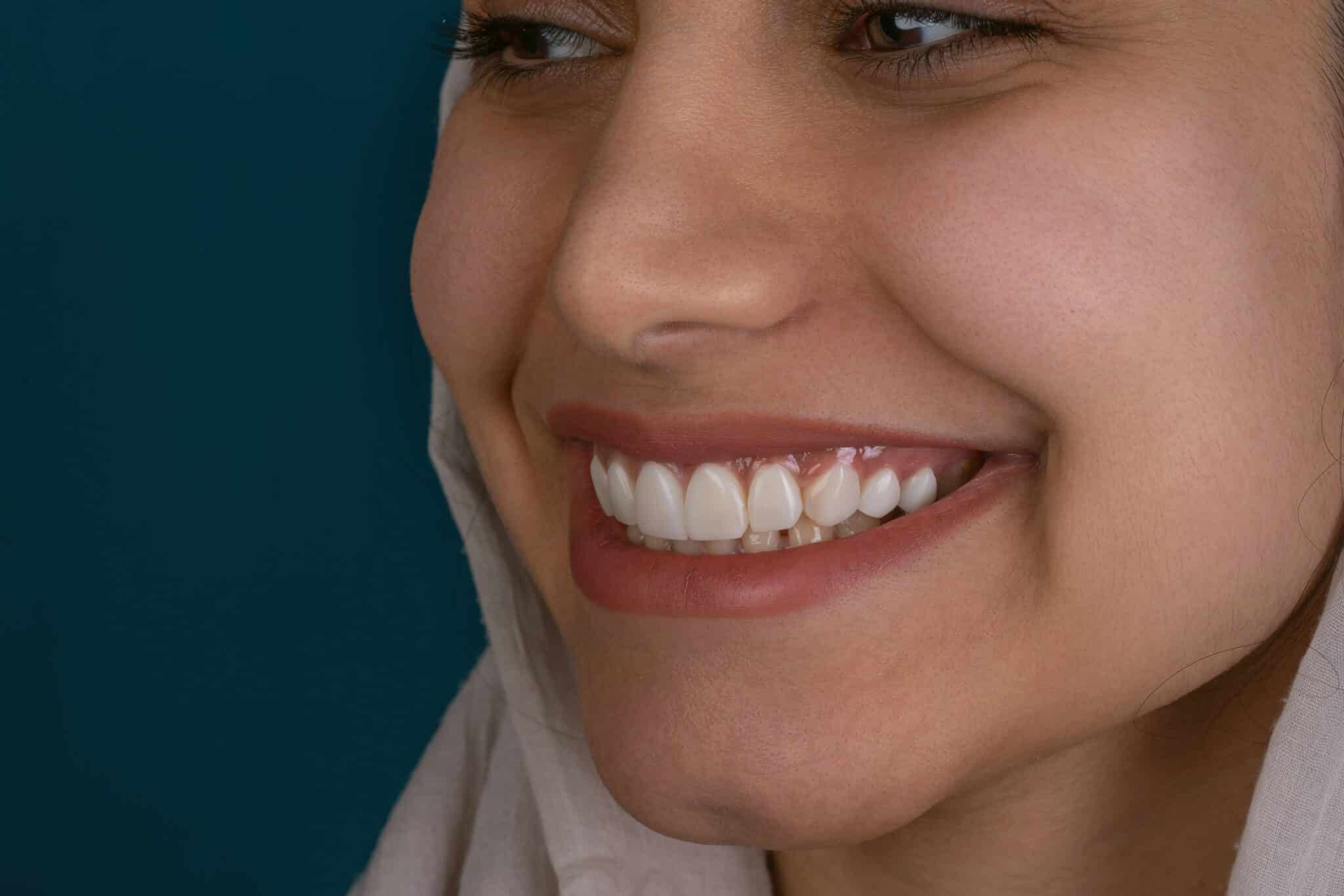 Insurance for Braces